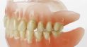 dentures